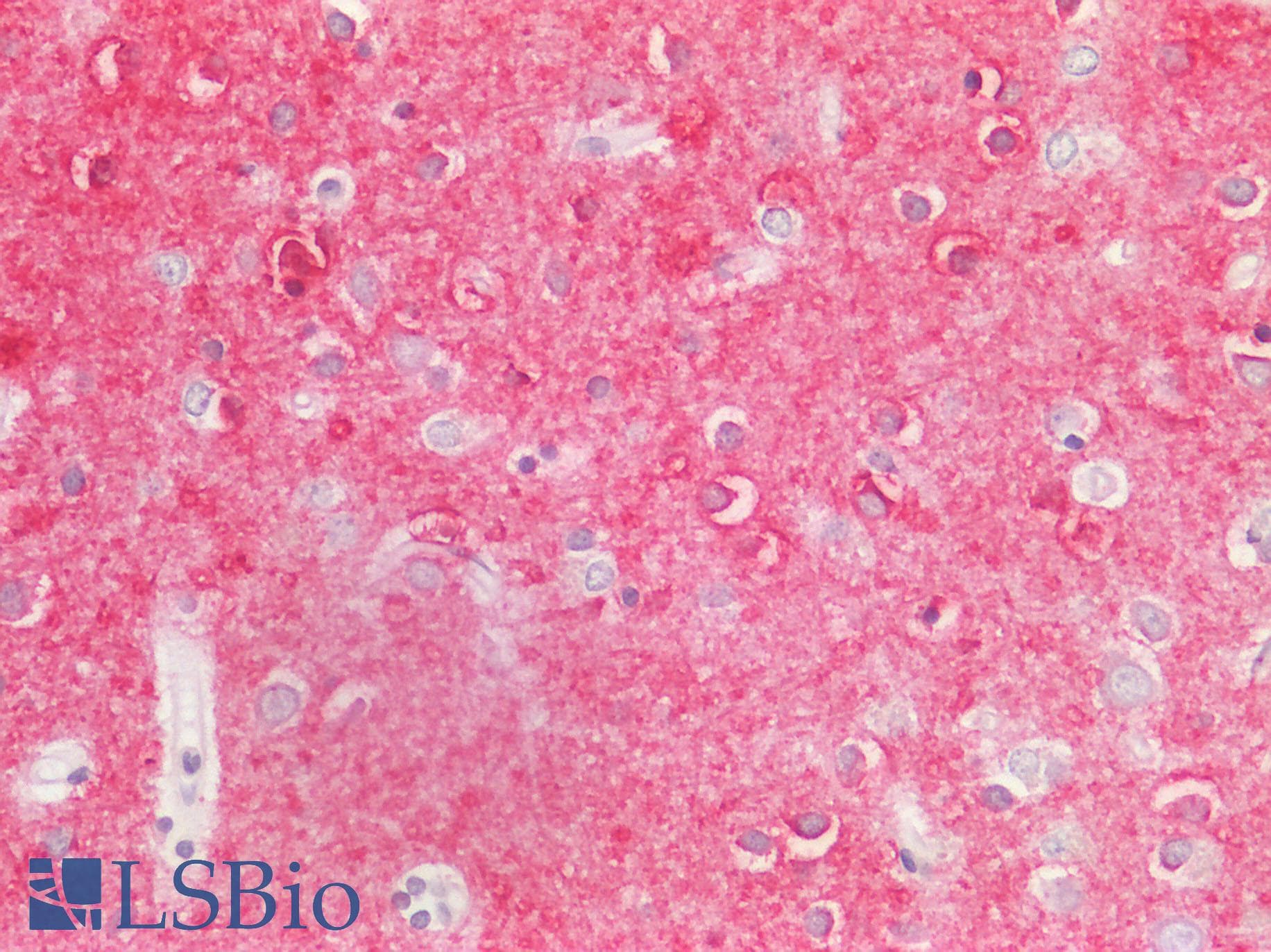 PathPlus™ Monoclonal Mouse anti-Human IL17A Antibody (clone 4K5F6, aa1-75, IHC, WB)