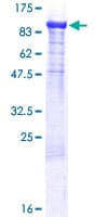 Human SCG2 / Secretogranin II Protein (Recombinant GST)