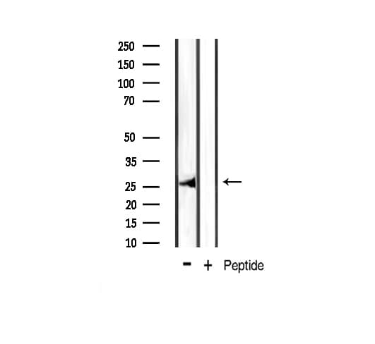 Polyclonal Rabbit anti-Human BCL2L1 / BCL-XL Antibody (phospho-Thr47, IHC, IF, WB)