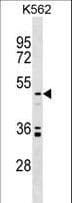Polyclonal Rabbit anti-Human UST Antibody (aa291-319, WB)