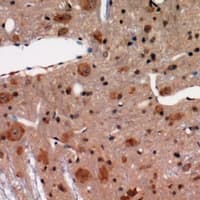 Neurofascin / NF Antibody