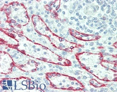 Neuraminidase Antibody (aa47-415)