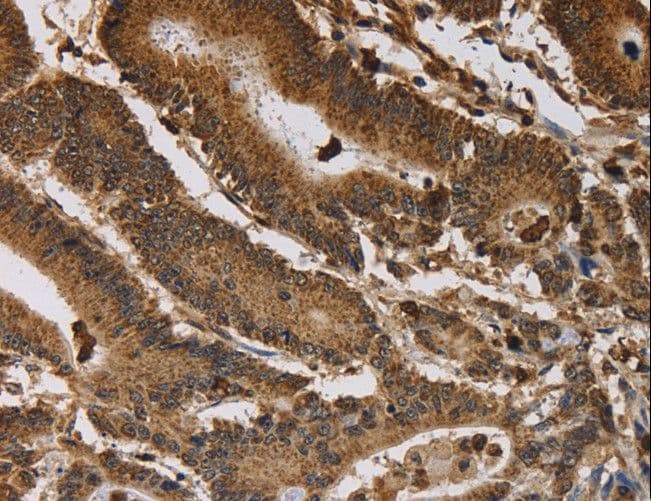 Polyclonal Rabbit anti-Human ITPR3 Antibody (IHC)
