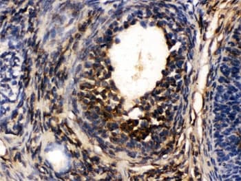 Polyclonal Rabbit anti-Human TCP1 Antibody (IHC, WB)