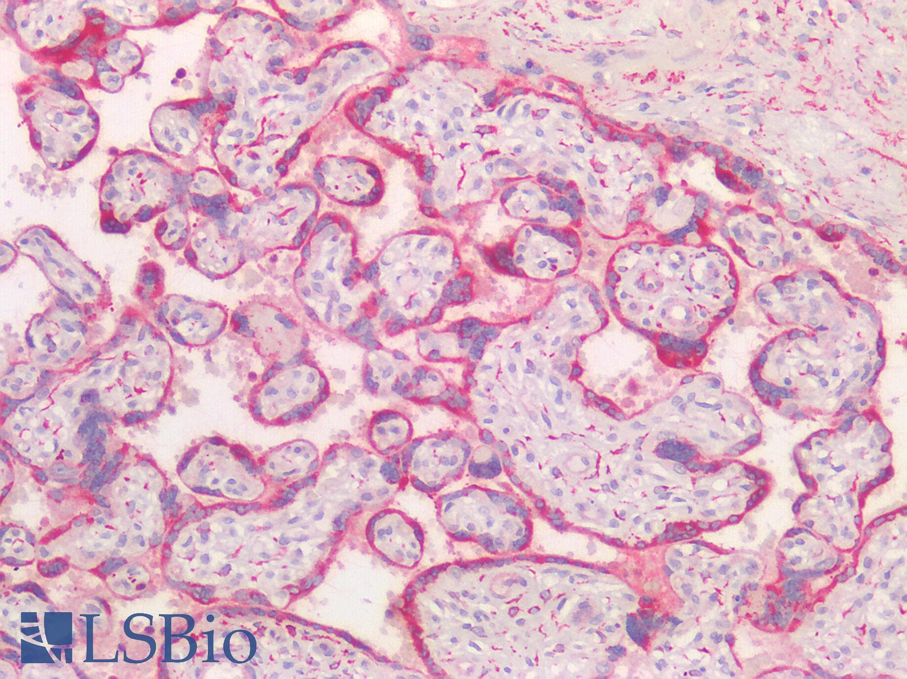 ORAOV1 Antibody