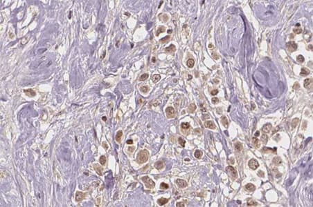 Polyclonal Rabbit anti-Human ER Alpha / Estrogen Receptor Antibody (phospho-Ser167, IHC, IF, WB)