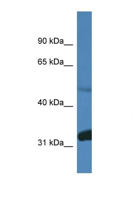 PPP2R2D Antibody (aa380-429)
