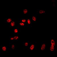 CUL2 / Cullin 2 Antibody (C-Terminus)