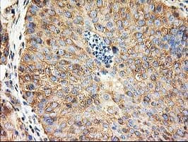 Monoclonal Mouse anti-Human TUBB4 / Tubulin Beta 4 Antibody (clone OTI5C1, IHC, IF, WB)