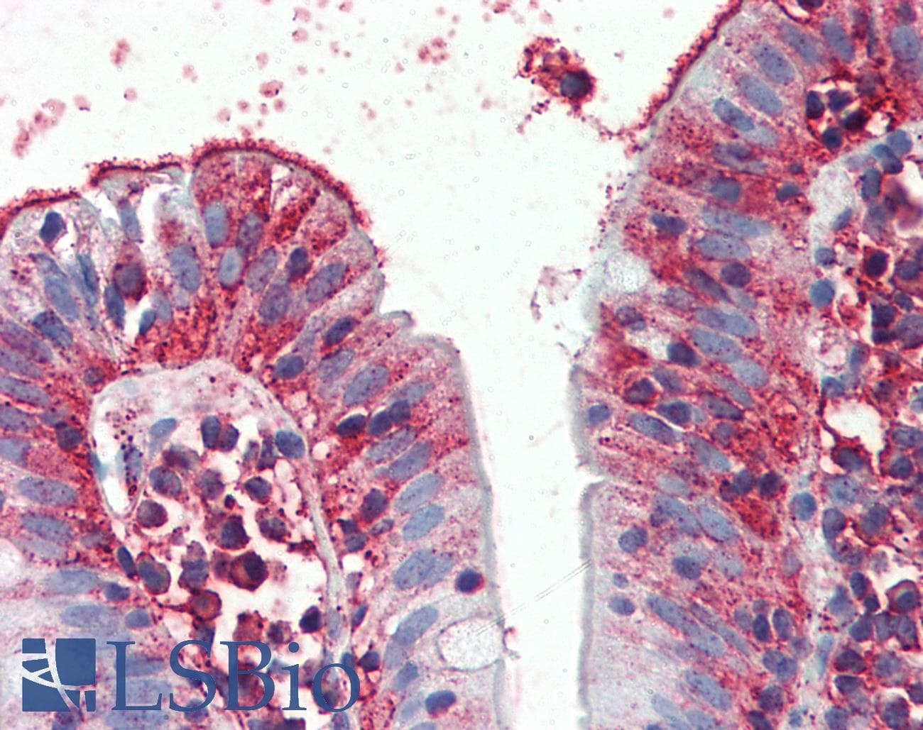 IHC-plus™ THEM6 / C8orf55 Antibody (Internal)