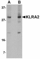 Polyclonal Rabbit anti-Mouse Klra2 Antibody (IHC, IF, WB)