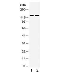 TRPM5 Antibody