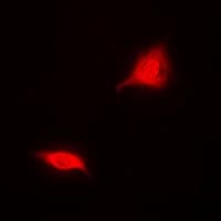 Polyclonal Rabbit anti-Human ASPA Antibody (IF, WB)