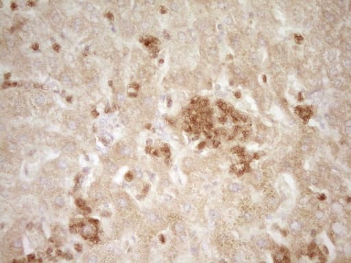 SLAMF7 / CRACC Antibody (clone OTI1F1)