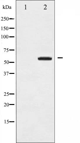 MAP3K8 / TPL2 Antibody (phospho-Thr290)