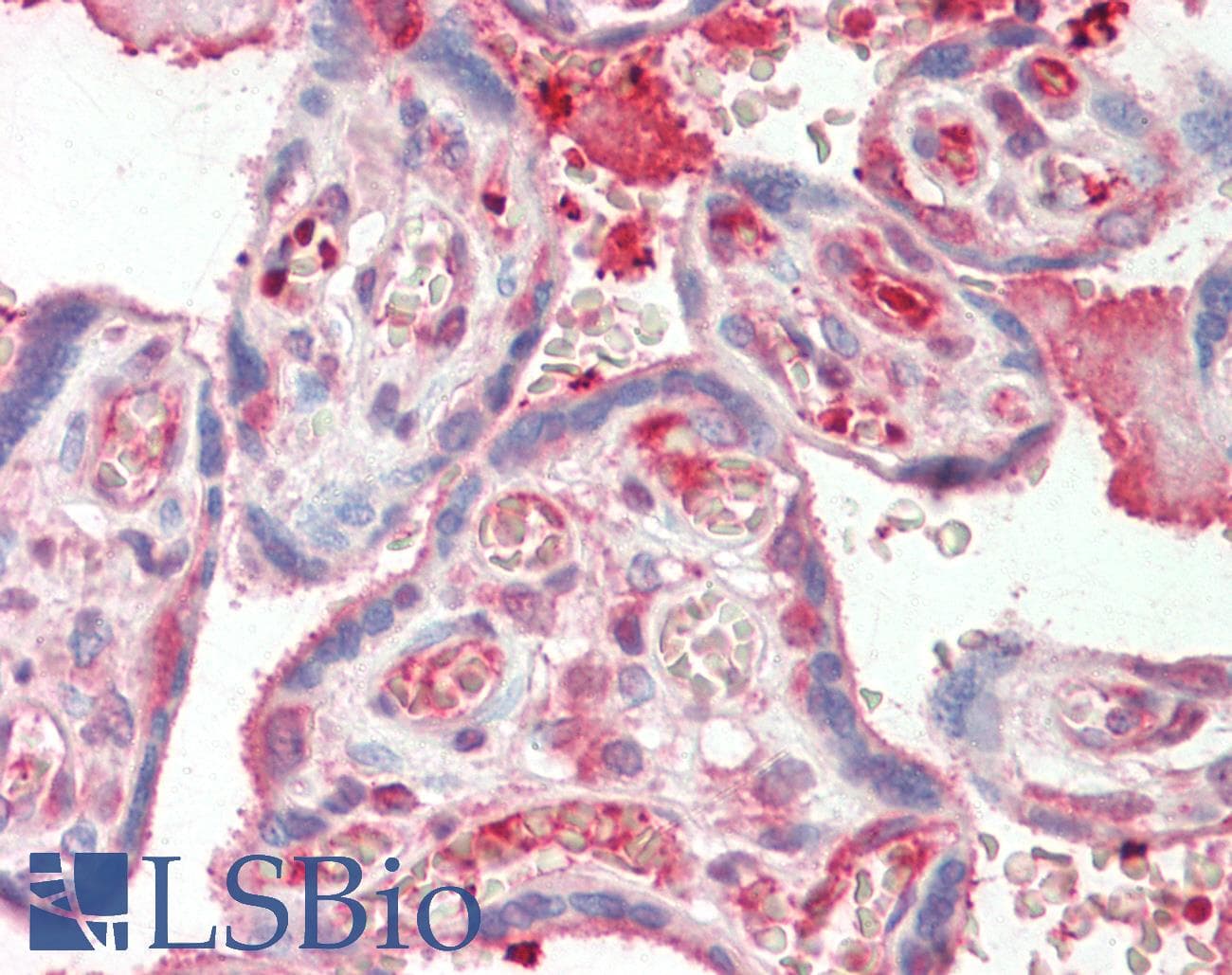 IHC-plus™ Monoclonal Mouse anti-Human SDC1 / Syndecan 1 / CD138 Antibody (aa210-238, IHC, IF, WB)
