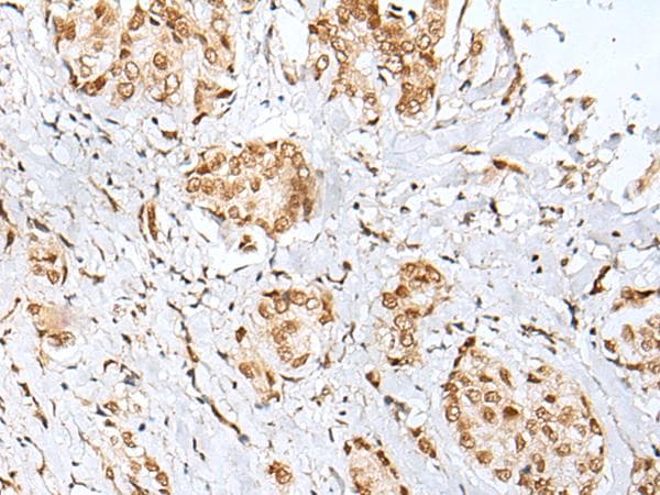 Polyclonal Rabbit anti-Human ZNF354A Antibody (IHC)