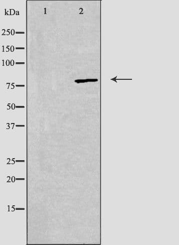 ADD2 Antibody