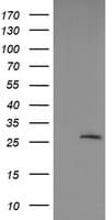 LGALS3 / Galectin 3 Antibody (clone OTI1A2)