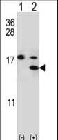 Calgizzarin / S100A11 Antibody (Ser6)