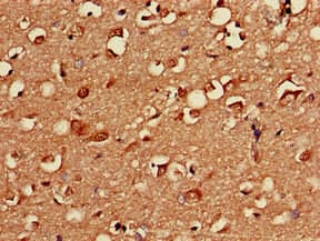 Polyclonal Rabbit anti-Human PRKACB Antibody (IHC, IF, WB)
