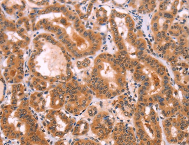 NCEH1 / AADACL1 Antibody