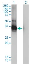 IHC-plus™ ARH / LDLRAP1 Antibody (clone 4G4-D5)