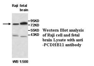 Polyclonal Rabbit anti-Human PCDHB11 Antibody (WB)