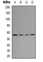 p56lck / LCK Antibody (Internal)