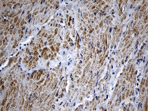MLC3F / MYL1 Antibody (aa2-150, clone OTI2E11)