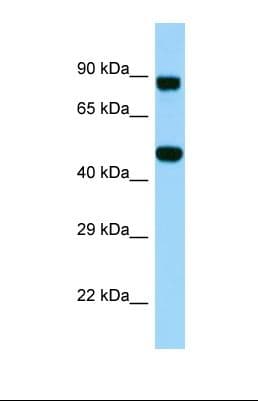 Polyclonal Rabbit anti-Human KDELC2 Antibody (aa303-352, WB)