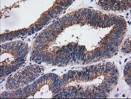 SULT1C2 / Sulfotransferase 1C2 Antibody (clone OTI4G1)