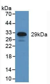 HNE / Neutrophil Elastase Antibody (aa30-247)