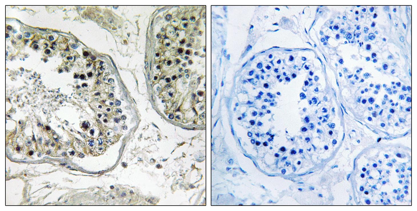 CHST13 Antibody