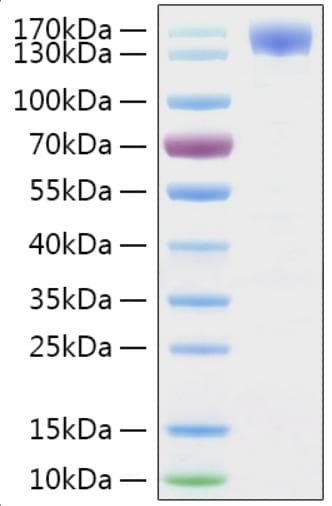 Coronavirus SARS-CoV-2 S1 Protein (Recombinant Human IgG Fc-6His, C-terminus)