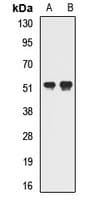 Polyclonal Rabbit anti-Human GTF2H4 / TFB2 Antibody (WB)