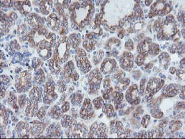 CRYZL1 Antibody (clone OTI2C3)