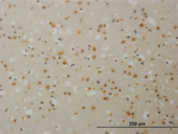 Monoclonal Mouse anti-Human TBL1X / TBL1 Antibody (clone 2B6, IHC)
