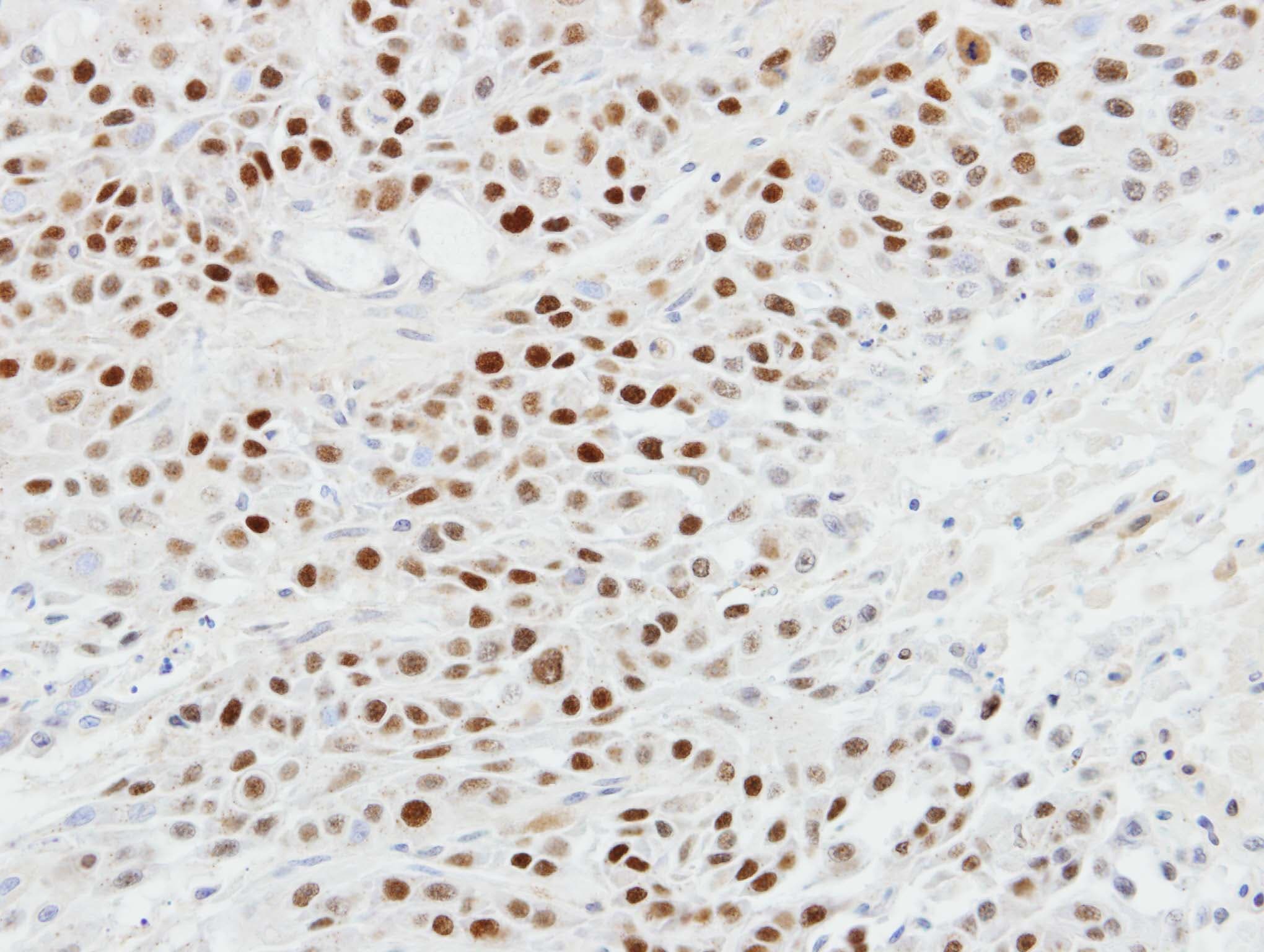 TP63 / p63 Antibody (aa125-415)