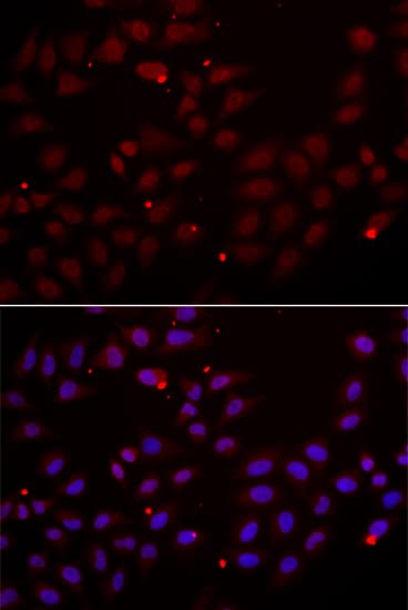 Cystatin SA / CST2 Antibody