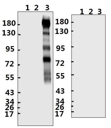 SARS-CoV-2 Spike Glycoprotein Antibody (aa 1138-1153)