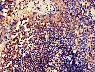 CELF2 / CUGBP2 Antibody