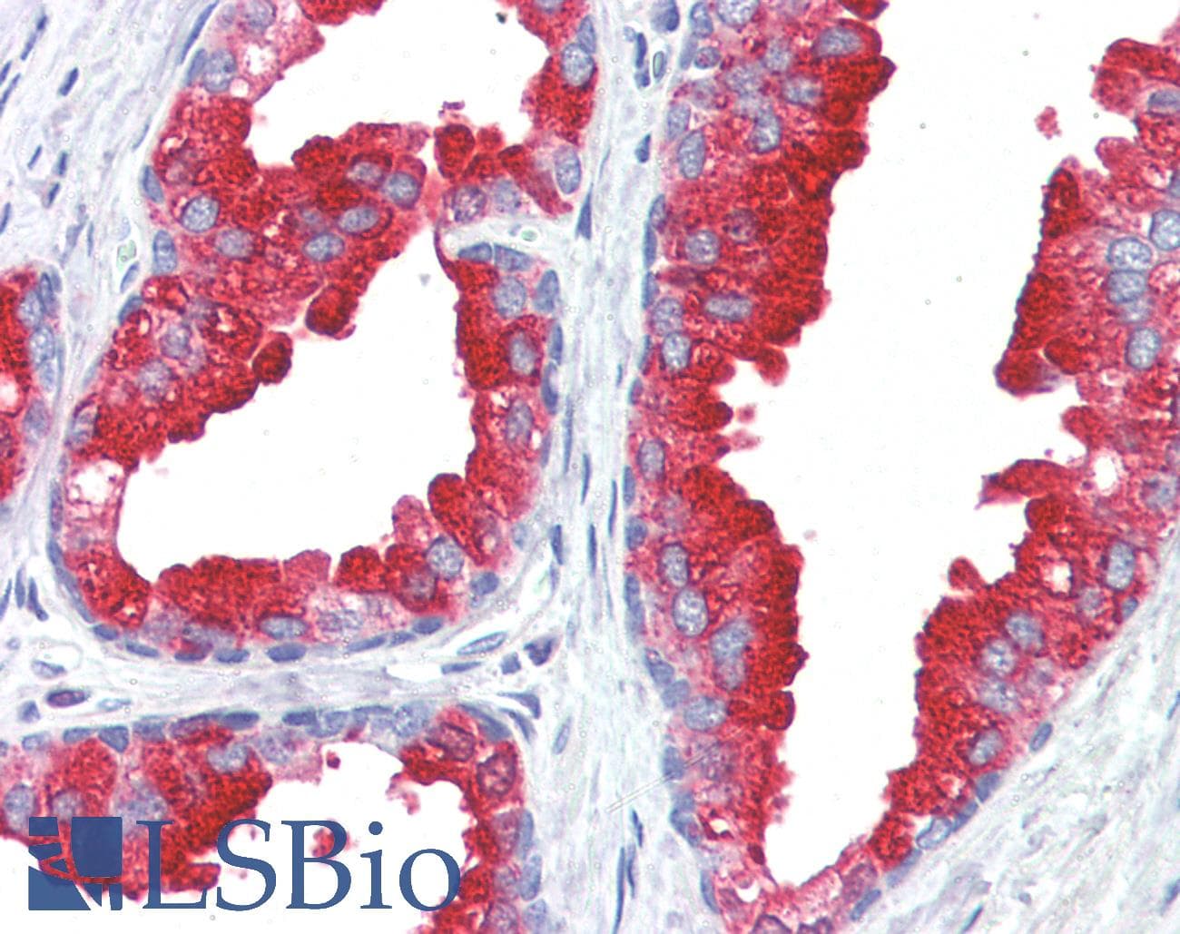 IHC-plus™ ACPP / PAP Antibody