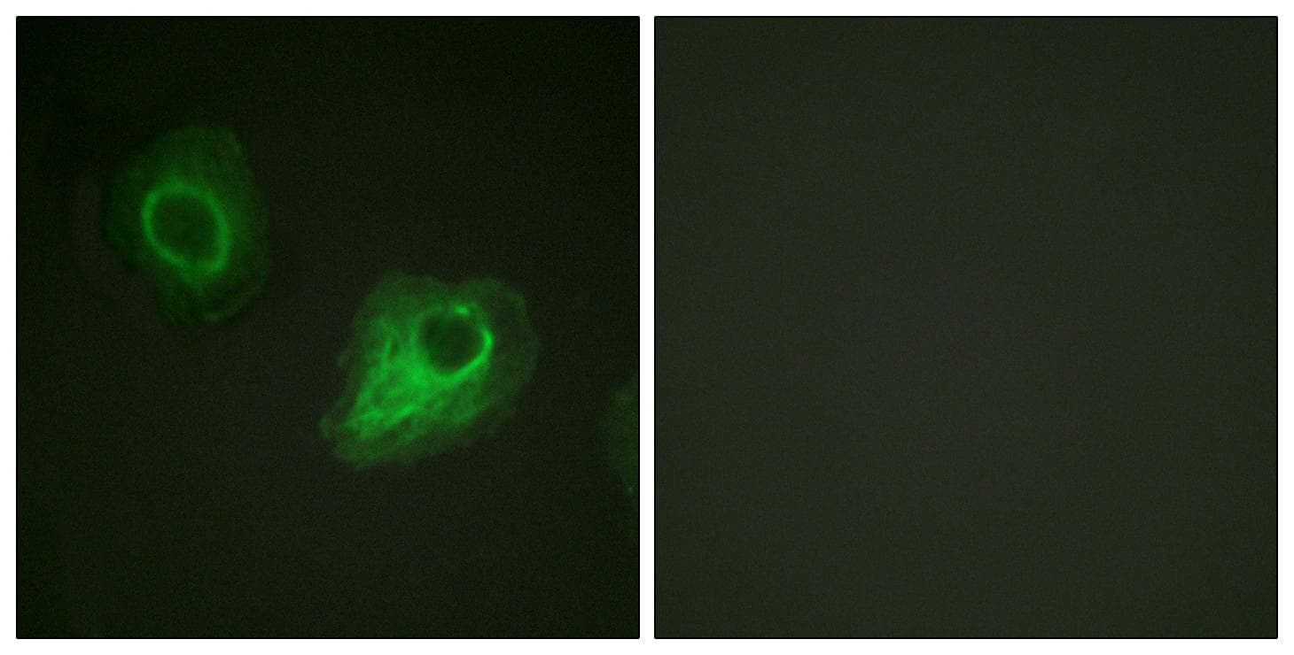 KDR / VEGFR2 / FLK1 Antibody