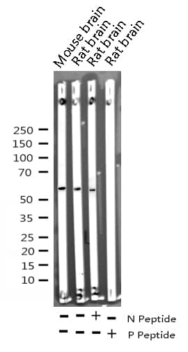 AKT1 Antibody (phospho-Ser473)