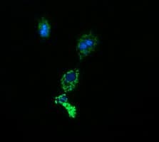 ACAA2 Antibody (clone OTI1D3)