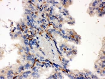 CYP27B1 Antibody