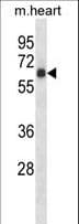 RPS6KB1 / P70S6K / S6K Antibody (aa481-509)