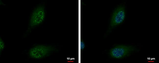 IHC-plus™ DBP5 / SON Antibody (aa1413-1628)