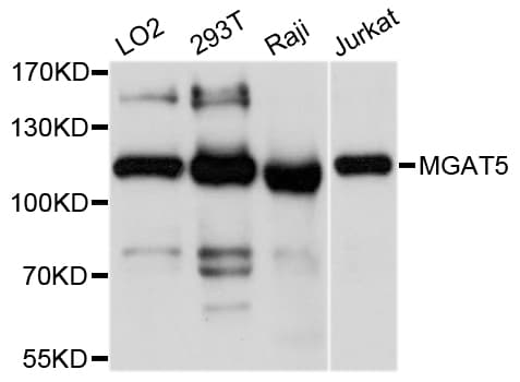 IHC-plus™ Polyclonal Rabbit anti-Human GNT-V / MGAT5 Antibody (IHC, WB)